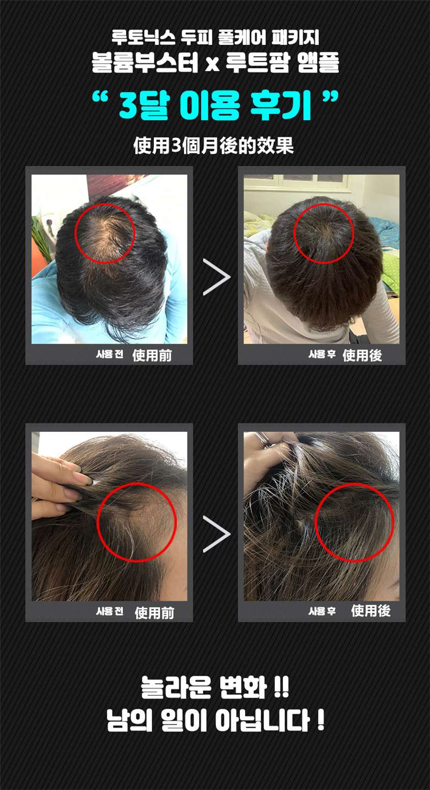 韓國無線LED震動按摩生髮儀